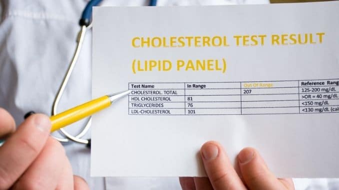 cholesterol-test-result