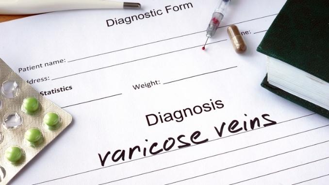 diagnosis-varicose-veins-pills