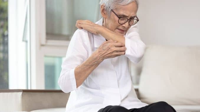 senior-woman-scratching-arm