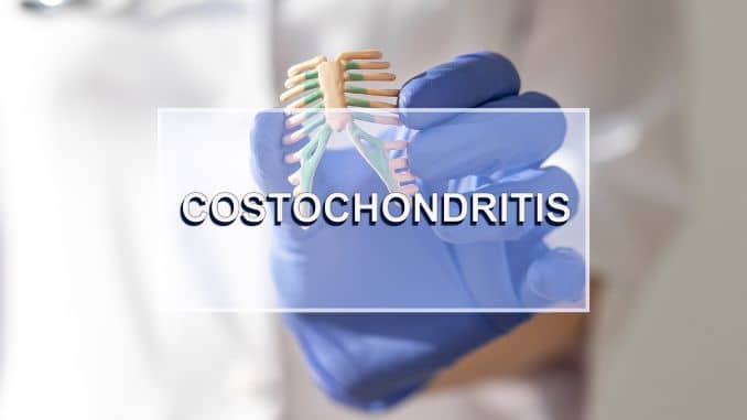 Is Costochondritis Dangerous - untitled image
