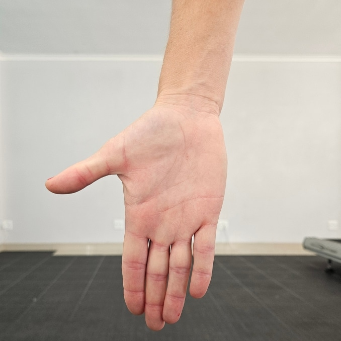 Thumb Extension/ Thumb flexion